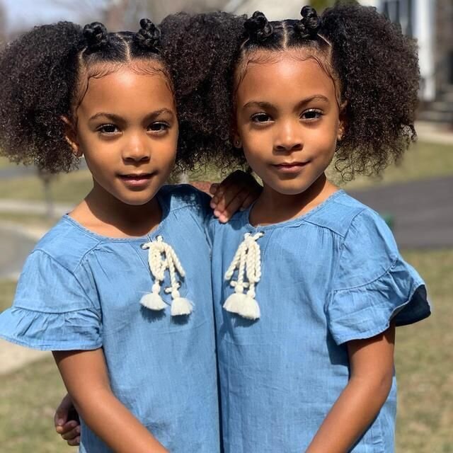 رمز و رازهای پزشکی: چند نوع دوقلو داریم؟ 13 رمز و رازهای پزشکی: چند نوع دوقلو داریم؟