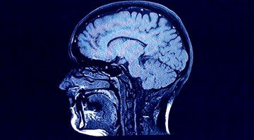 نشانگر بمب اتم در بدن انسان چیست؟ 8 bbc5.jpg