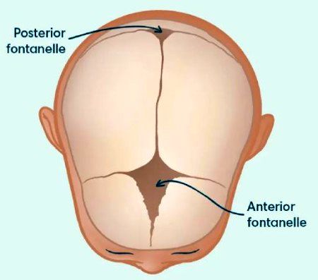 علل و درمان سفت شدن جمجمه نوزاد 4 درمان زود بسته شدن ملاج نوزاد