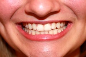 یک شرکت ژاپنی در مسیر تولید اولین دارو برای رویش دندان جدید 3 یک شرکت ژاپنی در مسیر تولید اولین دارو برای رویش دندان جدید