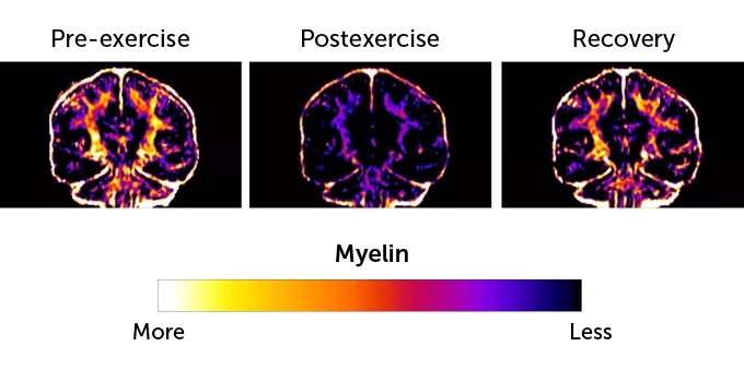 بدن دوندگان ماراتن به گمان زیادً در طول مسابقه بافت مغزی خود را هم مصرف میکند 2 1