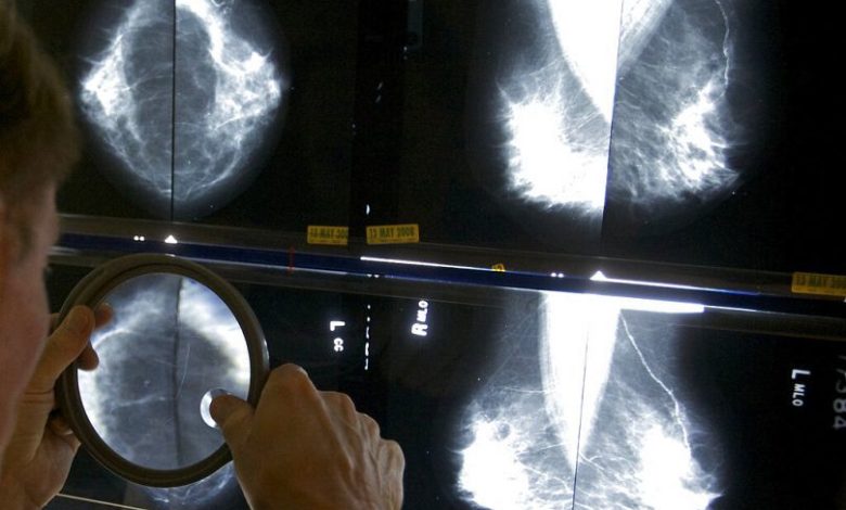 افزایش امیدها برای مهار سرطان پستان؛ دانشمندان عامل گسترش تومورها به دیگر نقاط بدن را کشف کردند 1 متاستاز به دیگر نقاط بدن یکی از مشکلات عمده سرطان پستان به شمار میرود