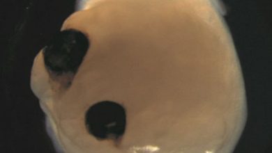 مغز ساخته شده توسط دانشمندان در آزمایشگاه، برای خود چشم ساخت!/ عکس 2 image_750x_6576b5b171c39