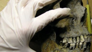 چرا وایکینگ ها همه انها پوسیدگی شدید دندان داشتند؟ 3 x