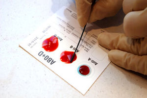 دارندگان این گروه خونی زیاد تر در خطر سکته می باشند 4 دارندگان این گروه خونی بیشتر در خطر سکته هستند