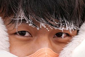 رابطه بین هوای سرد و سکته مغزی 6 رابطه بین هوای سرد و سکته مغزی