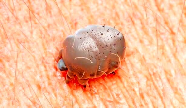 شیوع یک بیماری مُسری در انگلیس 3 شیوع یک بیماری مُسری در انگلیس؛ متخصصان نگران کمبود دارو هستند