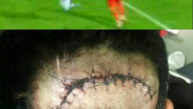 صدمه دیدن دردناک علی نعمتی/ خطر از بیخ گوش دفاع کننده قرمزها گذشت/ عکس 3 مصدومیت علی نعمتی