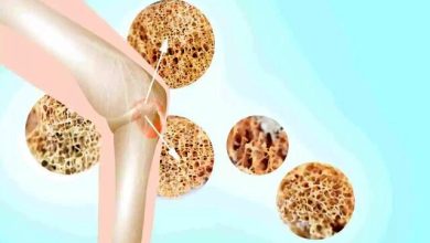 افت خطر پوکی استخوان با طبیعت 4 کاهش خطر پوکی استخوان با طبیعت