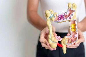 تشخیص سرطان روده بزرگ به پشتیبانی نوعی آزمایش خون تازه ممکن شد 5 تشخیص سرطان روده بزرگ به کمک نوعی آزمایش خون جدید ممکن شد