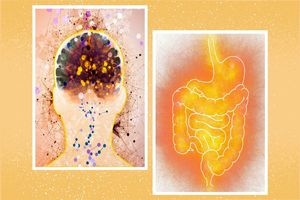آیا میگرن با افزایش خطر ابتلا به بیماری التهابی روده مرتبط است؟_بام وطن 3 آیا میگرن با افزایش خطر ابتلا به بیماری التهابی روده مرتبط است؟