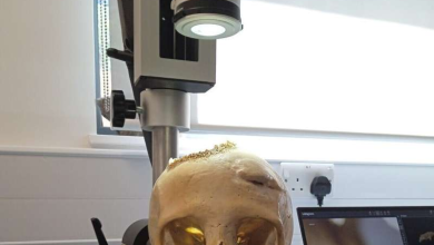 تلاش پزشکان مصر باستان برای درمان سرطان_بام وطن 5 171178424