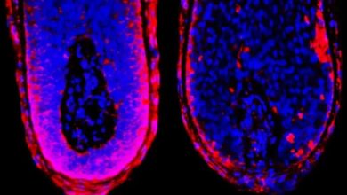 توقف ریزش مو با مسدود کردن یک مکانیسم زیستی_بام وطن 6 فولیکول مو