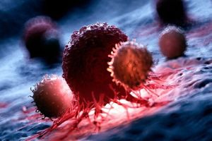 آخر کارآزمایی بالینی روی نانوداروی ضدسرطان حاوی RNA_بام وطن 3 پایان کارآزمایی بالینی روی نانوداروی ضدسرطان حاوی RNA