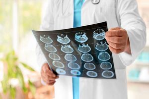 تشخیص آلزایمر از راه آزمایش خون با دقت ۹۱ درصدی ممکن میشود_بام وطن 2 تشخیص آلزایمر از راه آزمایش خون با دقت ۹۱ درصدی ممکن میشود