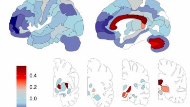 دانشمندان برای اولین بار از توزیع لیپید در مغز انسان نقشهبرداری کردند_بام وطن 5 لیپید