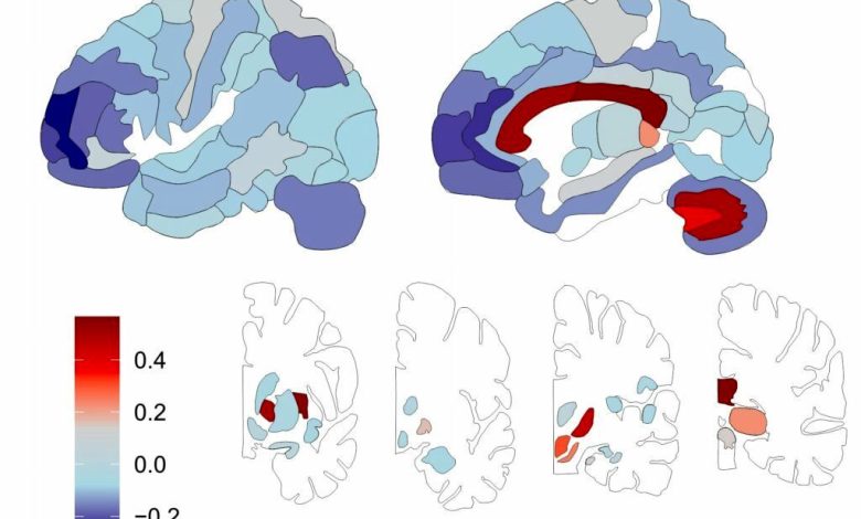 دانشمندان برای اولین بار از توزیع لیپید در مغز انسان نقشهبرداری کردند_بام وطن 1 لیپید