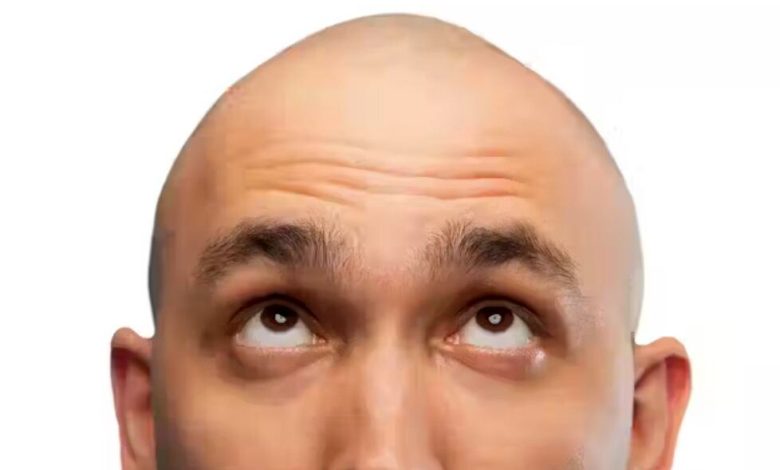 دیگر کسی در آینده تاس نمی‌شود/ دانشمندان در یک قدمی درمان