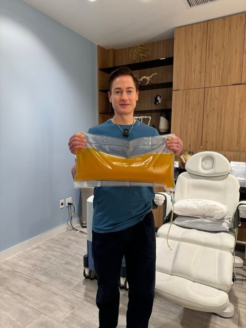 میلیاردر آمریکایی در سودای جوانی پلاسمای بدنش را معاوضه کرد!/ تصاویر_بام وطن 4 3