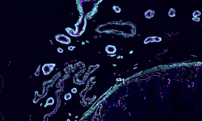 1920x1080_cmsv2_763c88fd-632b-57af-8473-2c016fec7e0c-8865386