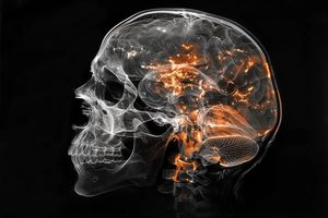 کشف منشأ تشکیل هراس و اضطراب در مغز؛ بارقه امیدی برای یافتن درمان_بام وطن 4 کشف منشأ ایجاد ترس و اضطراب در مغز؛ بارقه امیدی برای یافتن درمان