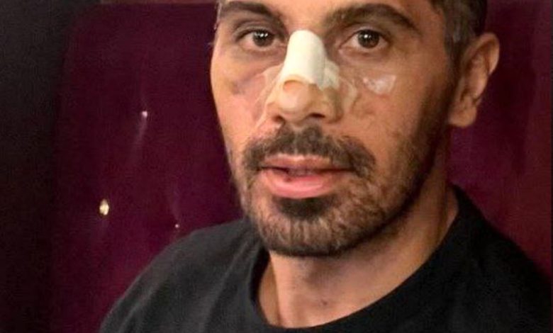 "نیو فیس" امید عالیشاه/ عکس_بام وطن 1 عکس| امید عالیشاه