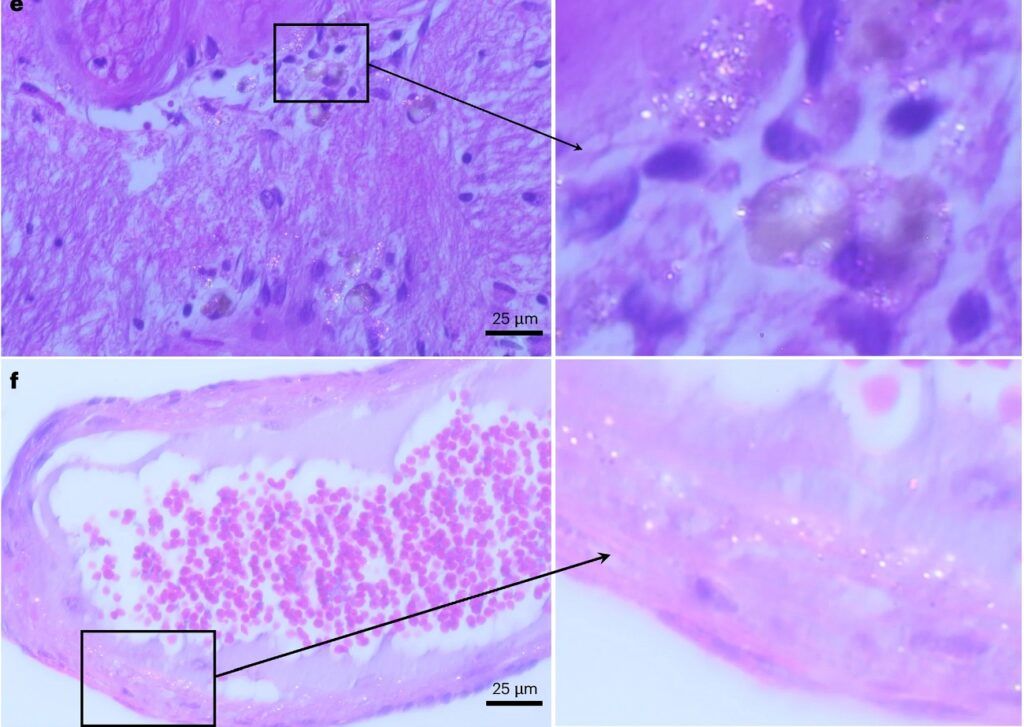 مقدار تجمع نانوپلاستیک در مغز انسان معادل یک قاشق است_بام وطن 4 نانوپلاستیک در مغز