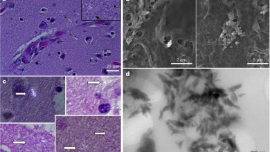 نانوپلاستیک در مغز