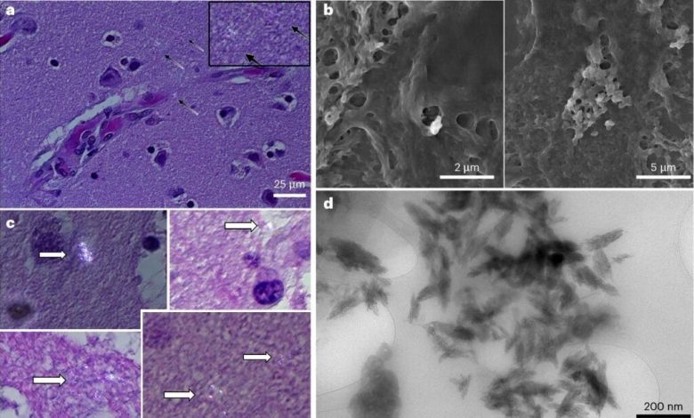 مقدار تجمع نانوپلاستیک در مغز انسان معادل یک قاشق است_بام وطن 3 نانوپلاستیک در مغز