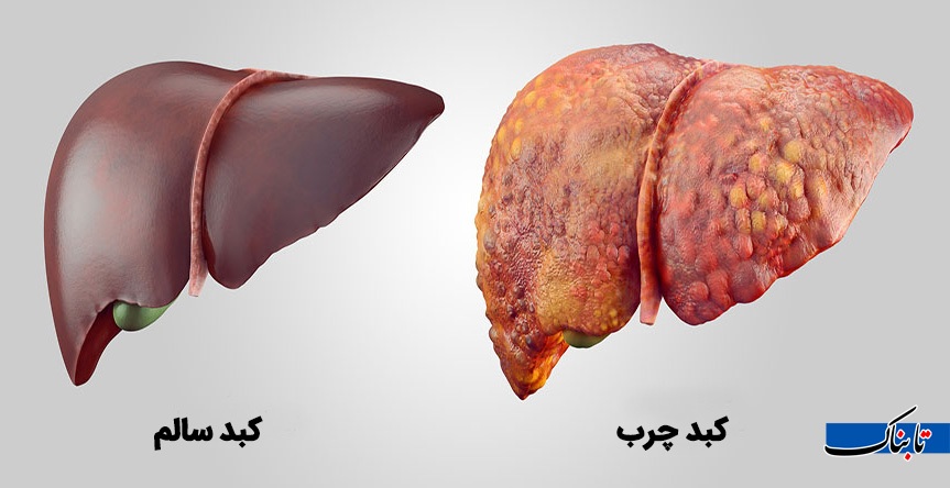 رژیم غذایی لاکژری شده و مردم بر خلاف گذشته انگیزه کاهش وزن ندارند / هزینه رژیم غذایی سالم در سال ۱۴۰۴ چقدر است؟