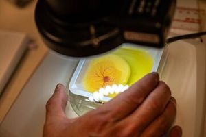 یافتن درمان مناسب برای سرطان با منفعت گیری از تخم مرغ_بام وطن 5 یافتن درمان مناسب برای سرطان با استفاده از تخم مرغ