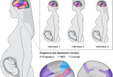 افسردگی دوران بارداری و تکامل عصبی جنین